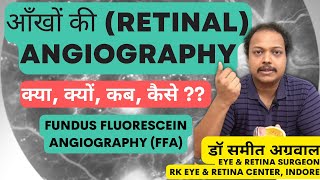 आँखों की Angiography. रेटिना के लिए बहुत ही useful होता है ये test.