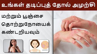 உங்கள் தடிப்புத் தோல் அழற்சி மற்றும் பூஞ்சை தொற்றுநோயைக் கண்டறியவும் | Tips to Treat Skin Disease