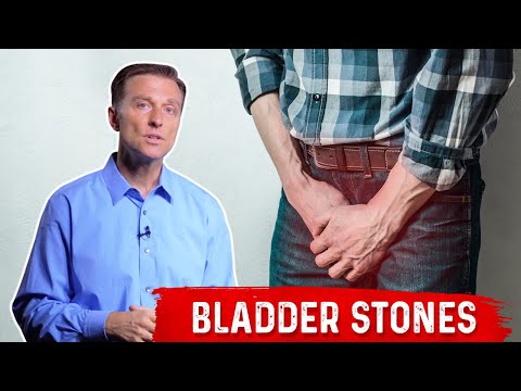 What To Do For Bladder Stones What To Do For Bladder Stones