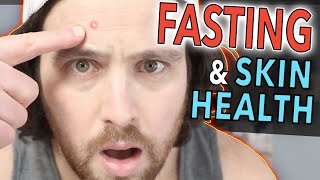Intermittent Fasting Skin Benefits | Can it Clear Up Your SKIN?