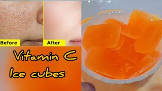 She rubs VITAMIN C ice cubes Daily \u0026 Closed LARGE OPEN PORES | Damage SKin Repair | Skin whitening