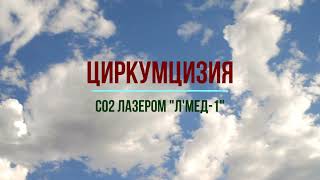 Циркумцизия СО2 лазером АЛМ-30-01 \