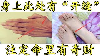 身上此处有“开缝”，注定命里有奇财，富贵挡都挡不住