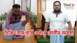 কোমর ও পায়ে ব্যথার জন্য শশী হাসপাতাল থেকে চিকিৎসার পূর্বে ও পরে রোগীর অবস্থা