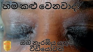 හම කළු වෙන්නට නියම හේතුව මෙන්න..Real cause for darkening of the skin