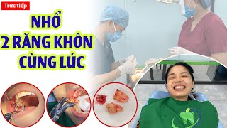 Cận cảnh nhổ 2 răng khôn cùng lúc, lợi trùm - lệch má