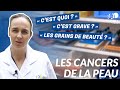 Les symptômes des cancers de la peau