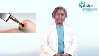 IORT | Dr. Prathima Sivaguru, Associate Consultant - Radiation Oncology at Aster CMI Hospital.