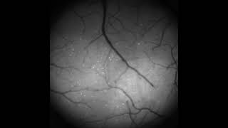 Spying on Thousands of Neurons in the Brain’s Vision Center Simultaneously