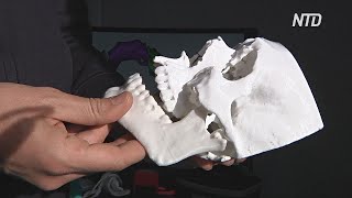 Итальянские врачи восстановили мужчине лицо с помощью 3D-печати