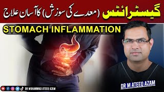 Treat Gastritis (Stomach inflammation) easily