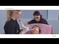 SmoothEye Laser Treatment for Tightening and Wrinkles