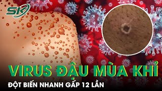 Virus Đậu Mùa Khỉ: Đột Biến Nhanh Gấp 12 Lần So Với Virus Thông Thường | SKĐS