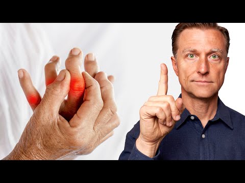 #1 Missing Trace Mineral in ARTHRITIS