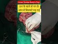 Linear Foreign Body in Pug dog and it's surgical removal by gastrostomy and enterotomy