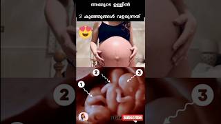 🥰🤰അമ്മയുടെ ഉള്ളിൽ 3കുഞ്ഞുങ്ങൾ വളരുന്നത് കണ്ടോ|triplets in mother womb #pregnancy #shorts #trending