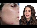 how to repair a broken skin barrier after using actives u0026 retinol how to protect skin barrier