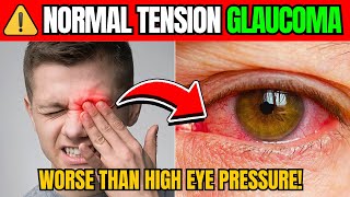 Normal Tension GLAUCOMA: The SILENT RISK No One Talks About!