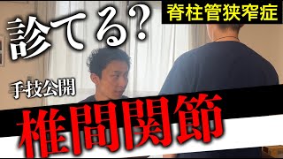 【手技公開】狭窄症では必須の椎間関節