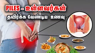 Foods piles patients should avoid | மூலம் இருப்பவர்கள் எந்த உணவை தவிர்க்க வேண்டும்?