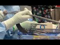 Dr Mustafa Alttahir Performs Femoral Osteotomy and Bone Lengthening