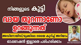 കുട്ടികളിലെ മൂക്കിലെ ദശ ( അഡിനോയിഡ് ) ഓപ്പറേഷൻ കൂടാതെ പരിഹരിക്കാം | Adenoid Malayalam | Dr.Unis