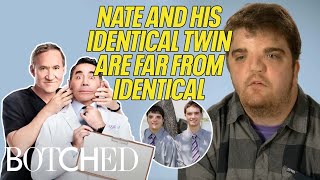 Doctors Help Nate Look More Identical to His Identical Twin (Botched By Nature) | Botched | E!