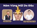 Nám Mũi Nguyên Nhân Do Đâu || Luận Japan || Bác Sĩ Ngô Thị Thu Yến