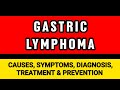 Gastric Lymphoma : Causes, Symptoms, Diagnosis, Treatment & Prevention | Gastromy Centre