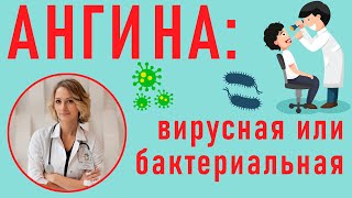 Ангины: вирусная и бактериальная