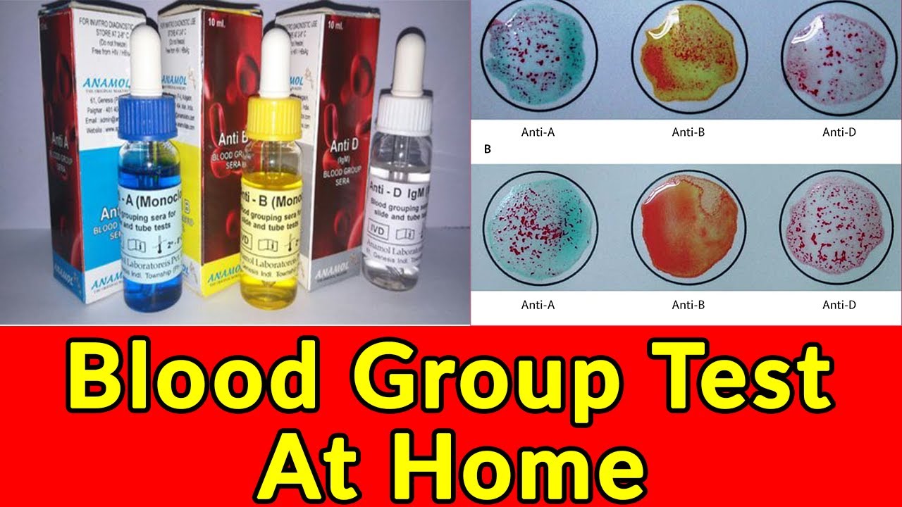 How To Test Blood Group-How To Test Blood Group At Home-how To Check ...