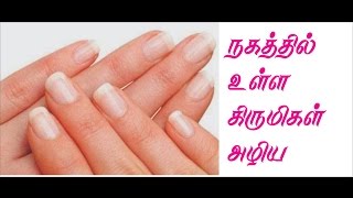 நகத்தில் உள்ள கிருமிகள் அழிய