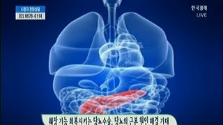 [메디컬 뉴스] 췌장 기능 회복시키는 당뇨수술,당뇨의 근본 원인 해결 기대