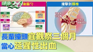 長輩撞頭宜觀察三個月 當心延遲性出血 健康2.0