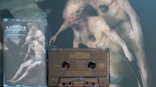 Vital Vinyl Vlog First Look: Acephalix - Theothanatology