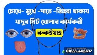 চোখে- মুখে -দাতে -জিহ্বা থাকায় যাদুর ঘিট খোলার কার্যকরী রুকইয়াহ !  Quranic Treatment BD