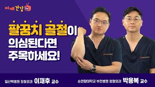 팔꿈치 골절이 의심 된다면 주목하세요!