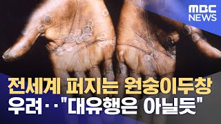 전세계 퍼지는 원숭이두창 우려‥\