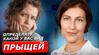 ВЫДАВЛИВАНИЕ ЭТИХ ПРЫЩЕЙ СТРОГО ЗАПРЕЩЕНО! Все что нужно знать о прыщах: виды, лечение, причины