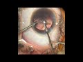 phaco surgery in a posterior subcapsular cataract with acryfold lens under topical anaesthesia