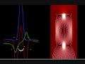 three soliton solution of the nonlinear schrödinger equation in the causal interpretation