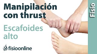 Manipulación osteopática con thrust para escafoides alto