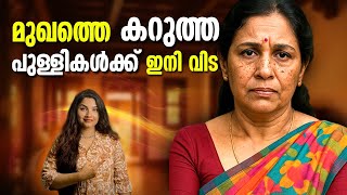 50 കളിലെ കറുത്ത പുള്ളികൾ തുടച്ച് നീക്കാം|മുഖം സുന്ദരമാക്കാം| skincare #naturalskincare #antiaging