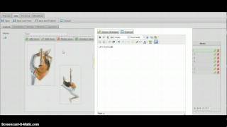 LoCD v1.00 (Custom EPiServer property)