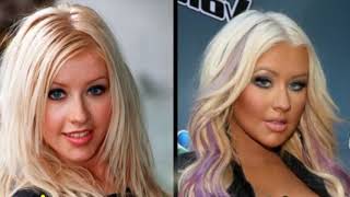 49 Celebrities Before and After Plastic Surgery