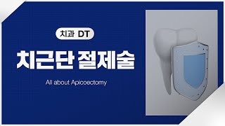 [치과] 치근단절제술 대상과 시술과정 알아보기!