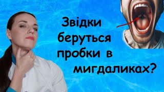 Пробки в мигдалинах причини, лікування, як позбутися. Хронічний тонзиліт