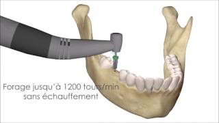 TURBOdrill Innovation IDI 2017