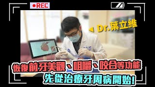 【專訪】恢復前牙美觀、咀嚼、咬合等功能，先從治療牙周病開始！