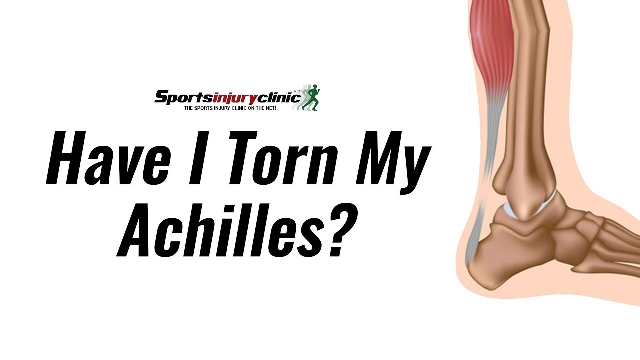Achilles Tendon Rupture Wikipedia 40 Off Achilles Tendon Rupture Wikipedia 40 Off